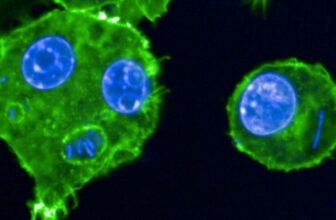 Plague Case Confirmed Close to Lake Tahoe After Doubtless Flea Chew